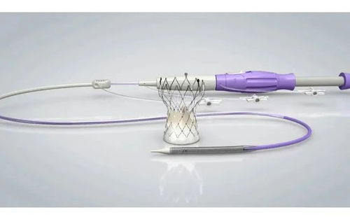 2021年園區(qū)5款創(chuàng)新醫(yī)療器械產(chǎn)品獲批上市，占全省71%